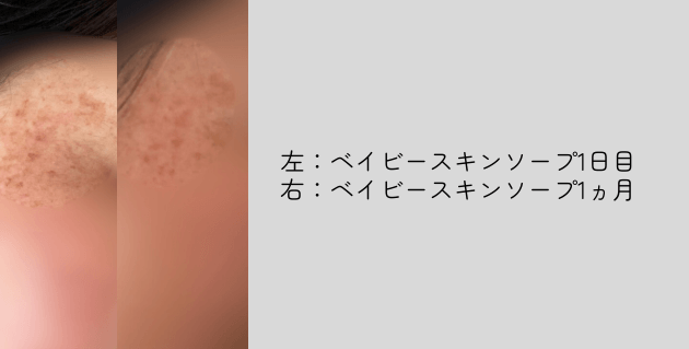 ベイビースキンソープの使用効果